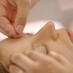 La acupuntura, clave de la belleza en Japón