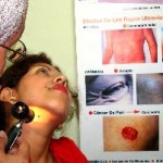 Perú: MINSA advierte que excesiva exposición solar provoca cáncer a la piel